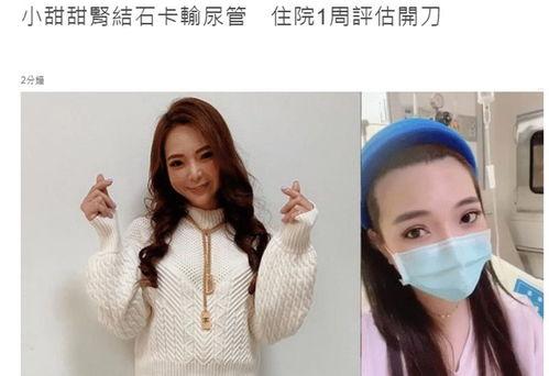 明星有结石,结石困扰背后的生活与饮食反思